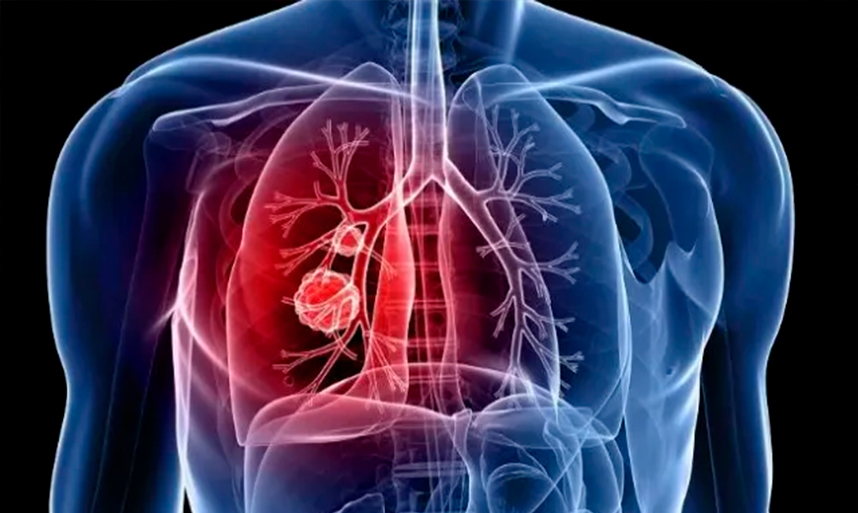 OMS estuda alargar laboratório de tuberculose de Maputo a estatuto regional